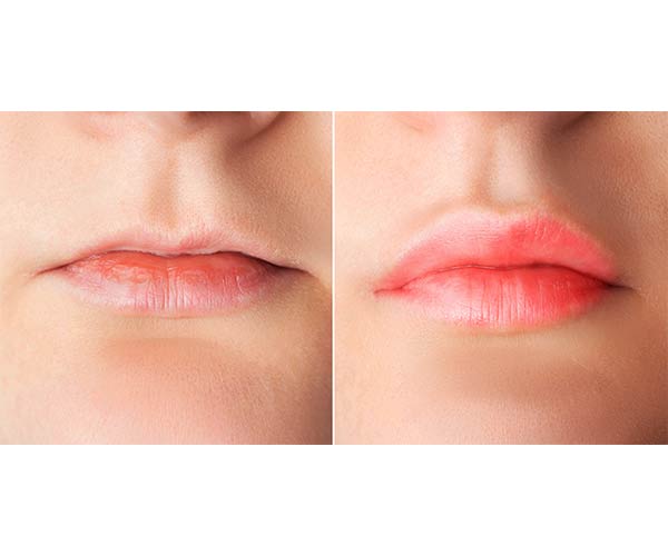 انواع ژل لب