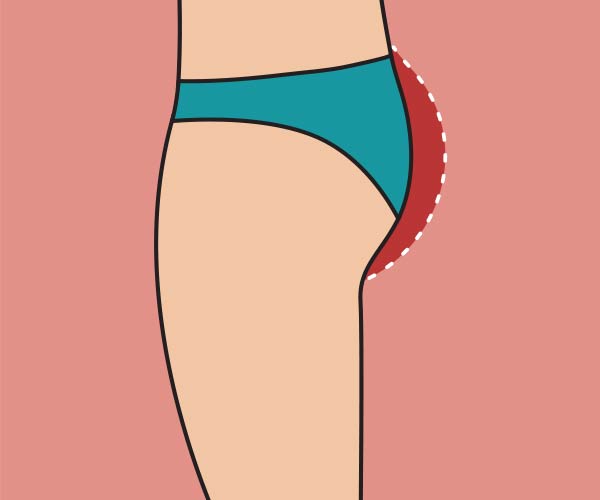 مزایای تزریق چربی برای باسن