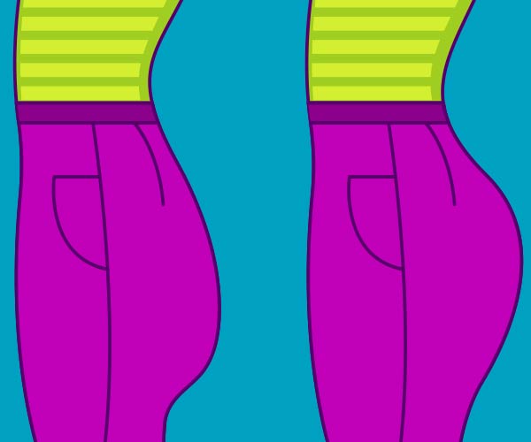 تزریق چربی به باسن