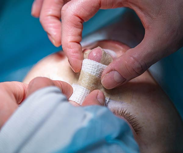 نحوه چسب زدن بینی