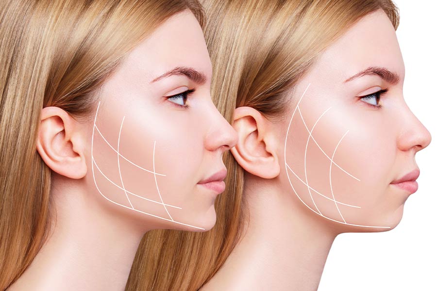 زاویه سازی فک چیست؟