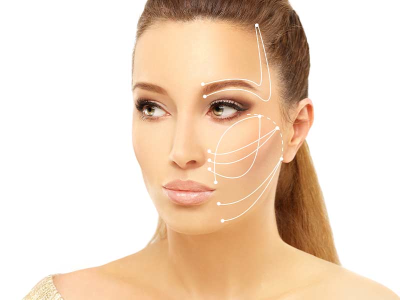 عوارض لیفت شقیقه با نخ