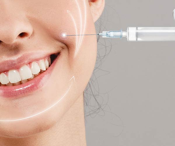 مزیت‌ها و معایب تزریق ژل خط خنده